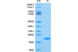 Human ENPP-3(48-157) on Tris-Bis PAGE under reduced condition. (ENPP3 Protein (AA 48-157) (His-Avi Tag))