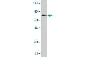 Western Blot detection against Immunogen (72. (KRT23 抗体  (AA 1-422))