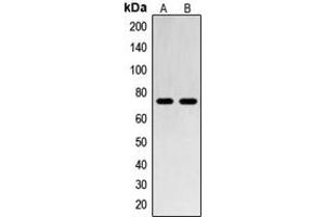 Western blot analysis of SENP1 expression in Jurkat (A), HL60 (B) whole cell lysates. (SENP1 抗体  (N-Term))