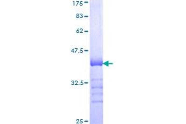 WASF2 Protein (AA 73-172) (GST tag)