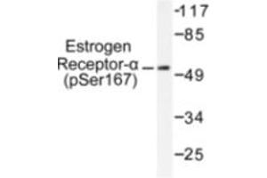 Image no. 1 for anti-Estrogen Receptor 1 (ESR1) (pSer167) antibody (ABIN318019) (Estrogen Receptor alpha 抗体  (pSer167))