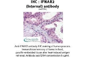 Image no. 2 for anti-Interferon alpha/beta Receptor 2 (IFNAR2) (Internal Region) antibody (ABIN1735773) (IFNAR2 抗体  (Internal Region))