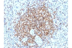 Immunohistochemistry (IHC) image for anti-B-Cell CLL/lymphoma 2 (BCL2) antibody (ABIN6940502)