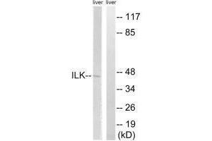 Western blot analysis of extracts from rat liver cells, using ILK (Ab-246) antibody. (ILK 抗体  (Ser246))