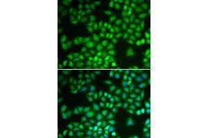 Immunofluorescence (IF) image for anti-Nuclear Factor of kappa Light Polypeptide Gene Enhancer in B-Cells 1 (NFKB1) (AA 740-964) antibody (ABIN6144571)