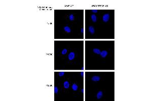 Immunocytochemistry/Immunofluorescence analysis using Mouse Anti-VPS35 Monoclonal Antibody, Clone 8A3 (ABIN6932968). (VPS35 抗体  (Biotin))