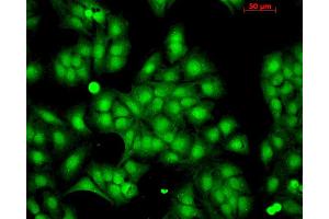 Immunocytochemistry/Immunofluorescence analysis using Rabbit Anti-HSP22 Polyclonal Antibody . (HSPB8 抗体  (PerCP))