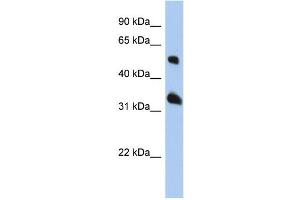 WB Suggested Anti-TSPAN33 Antibody Titration: 0. (TSPAN33 抗体  (Middle Region))