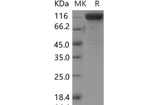 Nicastrin Protein (NCSTN) (Fc Tag)