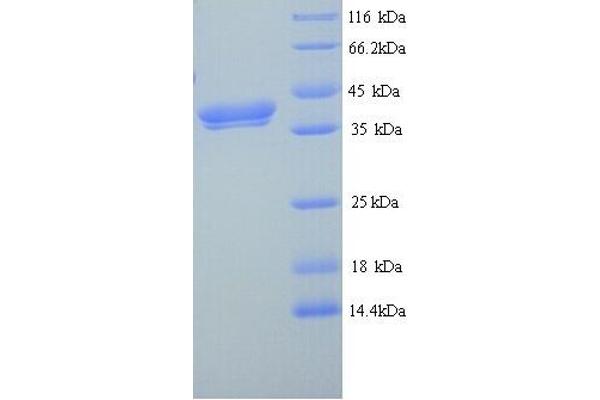 Erythroferrone (ERFE) (AA 25-340) protein (His tag)