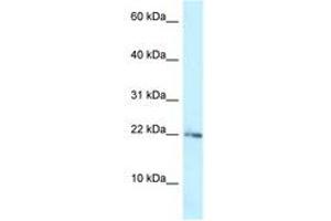 Image no. 1 for anti-Ribosomal Protein L23A (RPL23A) (AA 33-82) antibody (ABIN6747774) (RPL23A 抗体  (AA 33-82))