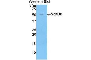 Western blot analysis of the recombinant protein. (TGM1 抗体  (AA 504-737))