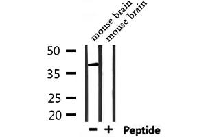 Western blot analysis of extracts from mouse brain, using RNF167 Antibody. (RNF167 抗体  (Internal Region))