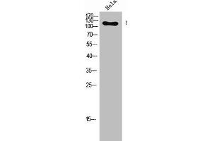 Western Blot analysis of Hela cells using Phospho-Flg (Y654) Polyclonal Antibody (FGFR1 抗体  (pTyr654))