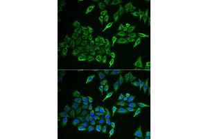Immunofluorescence analysis of HeLa cell using COX4I1 antibody. (COX IV 抗体)