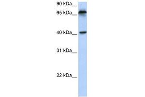 MICA antibody used at 1 ug/ml to detect target protein. (MICA 抗体  (N-Term))