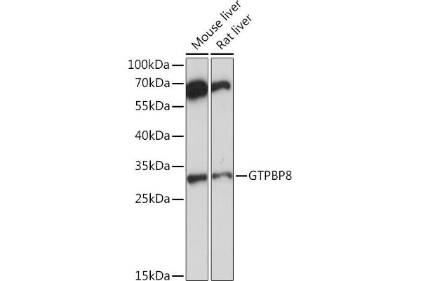 GTPBP8 抗体  (AA 1-170)
