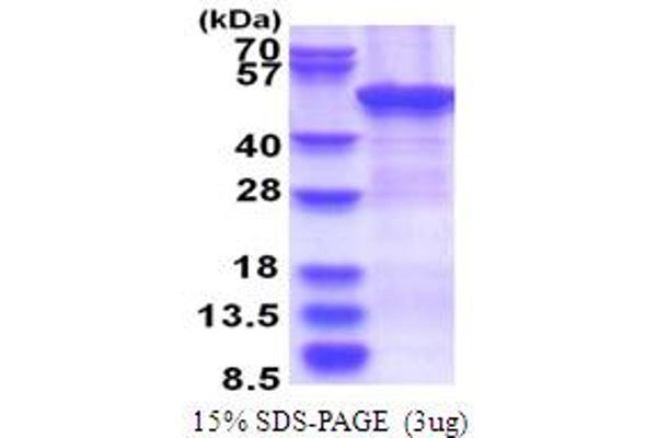 ZCCHC12 Protein (AA 1-402) (His tag)