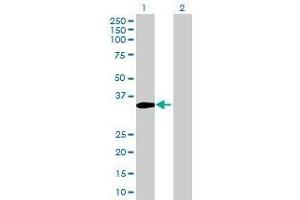 Lane 1: NAT9 transfected lysate ( 22. (NAT9 293T Cell Transient Overexpression Lysate(Denatured))