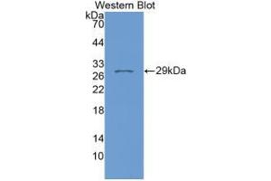 Western blot analysis of recombinant Human FKBP8. (FKBP8 抗体  (AA 93-339))