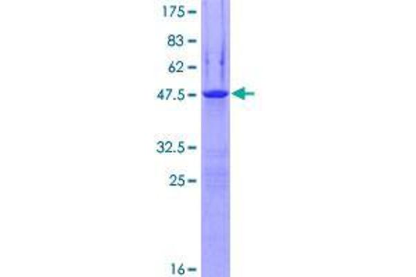 EPN3 Protein (AA 1-208) (GST tag)