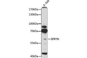 Western blot analysis of extracts of A-549 cells, using SPRTN antibody (ABIN4905287) at 1:3000 dilution. (Spartan 抗体)