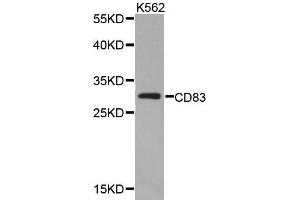 Western blot analysis of extracts of K562 cell lines, using CD83 antibody. (CD83 抗体  (AA 20-144))