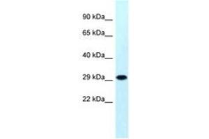 Image no. 1 for anti-Mitochondrial Ribosomal Protein S18B (MRPS18B) (AA 45-94) antibody (ABIN6747860) (MRPS18B 抗体  (AA 45-94))