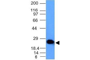 Western Blot Analysis of human Brain lysate using Pgp9. (UCHL1 抗体)