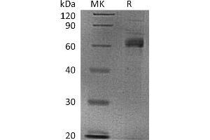 Greater than 95 % as determined by reducing SDS-PAGE. (NOG Protein (Fc Tag))