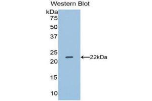 Western Blotting (WB) image for anti-Dual Specificity Phosphatase 3 (DUSP3) (AA 2-185) antibody (ABIN3201776) (Dual Specificity Phosphatase 3 (DUSP3) (AA 2-185) 抗体)