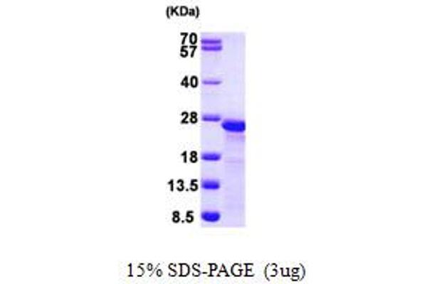 MYL9 Protein (AA 1-172) (His tag)