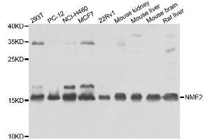 Western blot analysis of extracts of various cell lines, using NME2 antibody. (NME2 抗体  (AA 1-152))