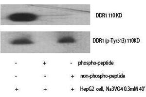 Western Blotting (WB) image for anti-Discoidin Domain Receptor tyrosine Kinase 1 (DDR1) (pTyr513) antibody (ABIN3182685) (DDR1 抗体  (pTyr513))