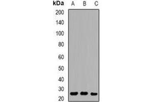 Western blot analysis of RAB27 expression in Hela (A), U937 (B), Jurkat (C) whole cell lysates. (RAB27A 抗体)