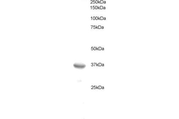 BCL7A 抗体  (C-Term)