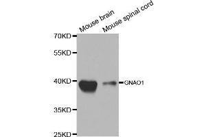 Western blot analysis of extracts of various cell lines, using GNAO1 antibody. (GNAO1 抗体)