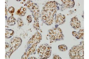 Immunohistochemistry (Formalin-fixed Paraffin-embedded Sections) (IHC (fp)) image for anti-serine Hydroxymethyltransferase 1 (Soluble) (SHMT1) (AA 374-482) antibody (ABIN562870)