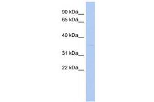 Image no. 1 for anti-STIP1 Homology and U-Box Containing Protein 1 (STUB1) (N-Term) antibody (ABIN6743148) (STUB1 抗体  (N-Term))