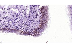 Paraformaldehyde-fixed, paraffin embedded rat bladder, Antigen retrieval by boiling in sodium citrate buffer (pH6) for 15min, Block endogenous peroxidase by 3% hydrogen peroxide for 30 minutes, Blocking buffer (normal goat serum) at 37°C for 20min, Antibody incubation with , Unconjugated  at 1:400 overnight at 4°C, followed by a conjugated secondary and DAB staining. (Ccl26 Signal Peptide (AA 1-70) 抗体)