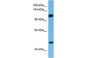 Host:  Rabbit  Target Name:  IFIH1  Sample Tissue:  Human Esophagus Tumor lysates  Antibody Dilution:  1ug/ml (IFIH1 抗体  (Middle Region))