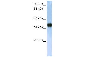 Western Blotting (WB) image for anti-Zinc Finger, CCHC Domain Containing 17 (ZCCHC17) antibody (ABIN2458243) (ZCCHC17 抗体)