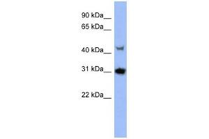 PRKY antibody used at 1 ug/ml to detect target protein. (PRKY 抗体  (N-Term))