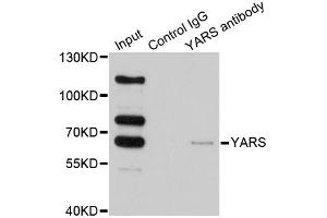 Immunoprecipitation analysis of 200 μg extracts of HeLa cells using 1 μg YARS antibody (ABIN5974115). (YARS 抗体)