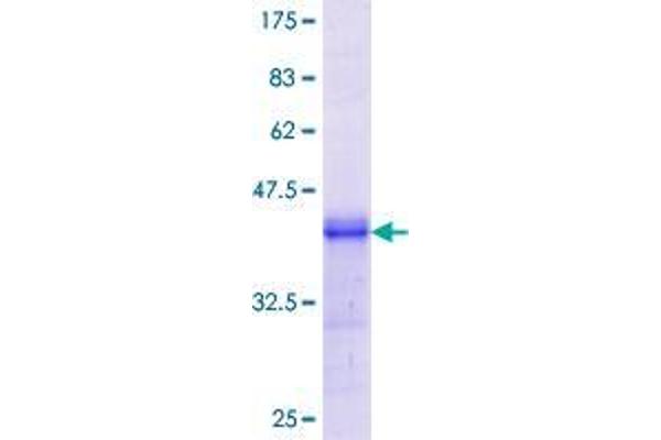 DISP1 Protein (AA 1-101) (GST tag)