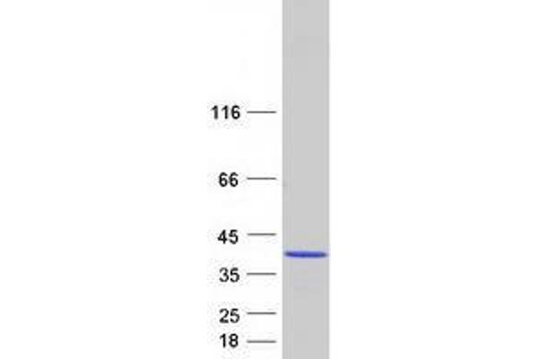 CHMP3 Protein (Transcript Variant 1) (Myc-DYKDDDDK Tag)