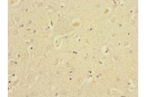 Immunohistochemistry of paraffin-embedded human brain tissue using ABIN7151514 at dilution of 1:100 (EAF2 抗体  (AA 1-170))