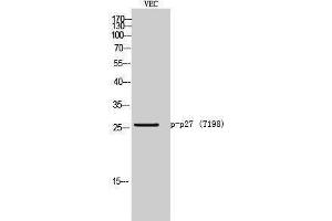 Western Blotting (WB) image for anti-P27 (pThr198) antibody (ABIN3182256) (P27 (pThr198) 抗体)