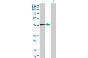 Western Blot analysis of ACTRT2 expression in transfected 293T cell line by ACTRT2 MaxPab polyclonal antibody. (ACTRT2 抗体  (AA 1-377))