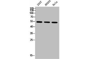 Western blot analysis of 293T AD293 Hela using p-Parkin (S131) antibody. (Parkin 抗体  (pSer131))